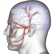 Trigeminal Neuralgia