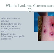 Pyoderma Gangrenosum