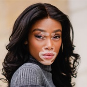 Winnie Harlow