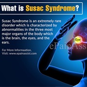 Susac&#39;s Syndrome