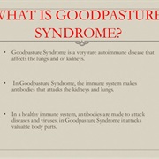 Goodpasture&#39;s Syndrome