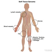 Soft Tissue Sarcomas