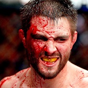 Carlos Condit