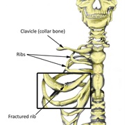 Injuries, Diseases, and Illnesses - Page 3