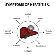 Hepatitis C