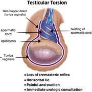 Gonadal Torsion