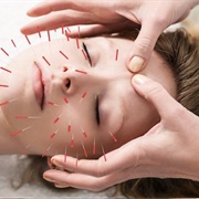 Try Acupuncture