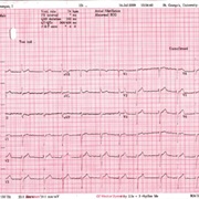 Electrocardiography