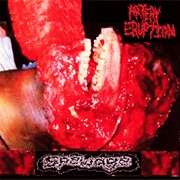 Artery Eruption - Spewage