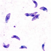 Toxoplasmosis