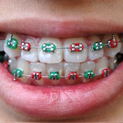 Braces