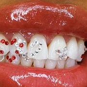 Tooth Gems