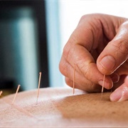 Acupuncture