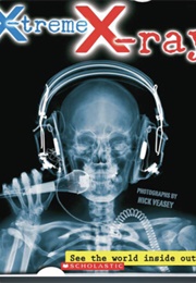 X-Treme X-Ray (Nick Veasey)