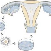 IVF Works Where Other Infertility Treatments Fail.