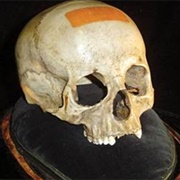 Mozart&#39;s Skull