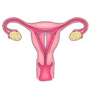 IUD Insertion