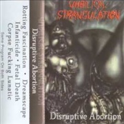 Umbilical Strangulation - Disruptive Abortion