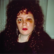 Nan One Month After Being Battered (Nan Goldin)