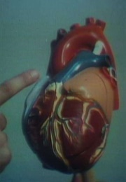 Open Heart Surgery (1975)