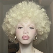 Albinism