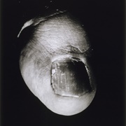 Big Toe, Masculine Subject, Thirty Years Old, Documents, No. 6, 1929 (Jacques-André Boiffard)