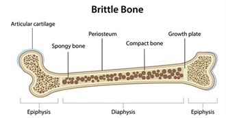 Notable People With Osteogenesis Imperfecta